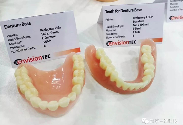 3D打印全口假牙