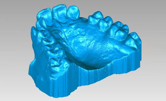 口腔正畸使用EnvisionTEC 3D打印机，创造无限可能性