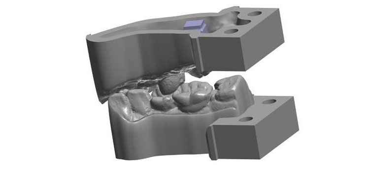 经济实惠，EnvisionTEC 3D打印推动齿科实验室数字化
