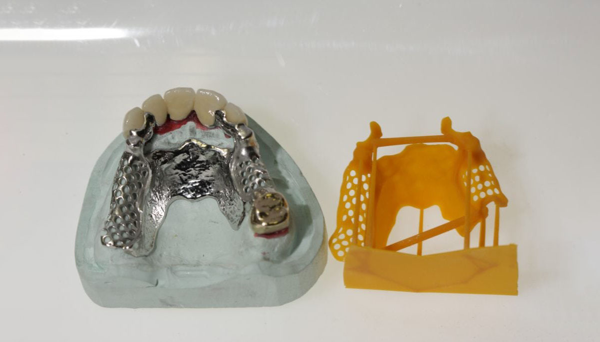 齿科福音！齿科实验室使用EnvisionTEC 3D打印，大幅提高生产效率
