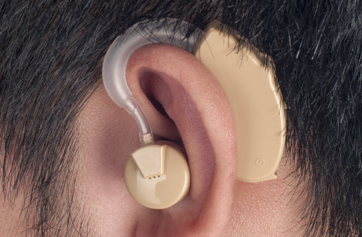 3D打印助听器